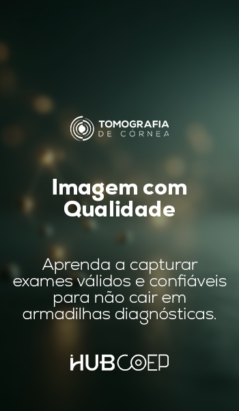 coep-hub-tomografia-cornea-imagem-com-qualidade